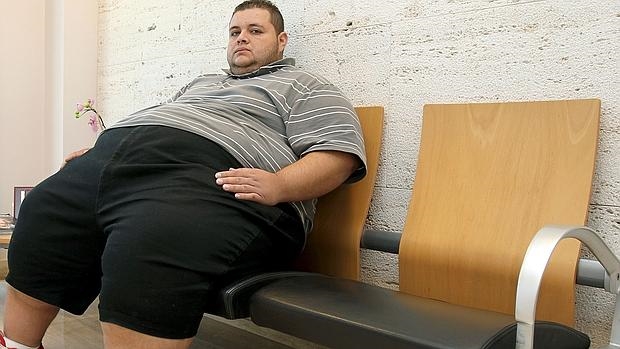Obesidad, más letal para los hombres que para las mujeres