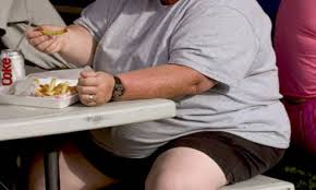 Presiona al sistema de salud obesidad mórbida